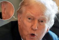 Donald Trump Ear Bandage Donald Trump Wears Small Band-aid On Ear During Michigan Rally