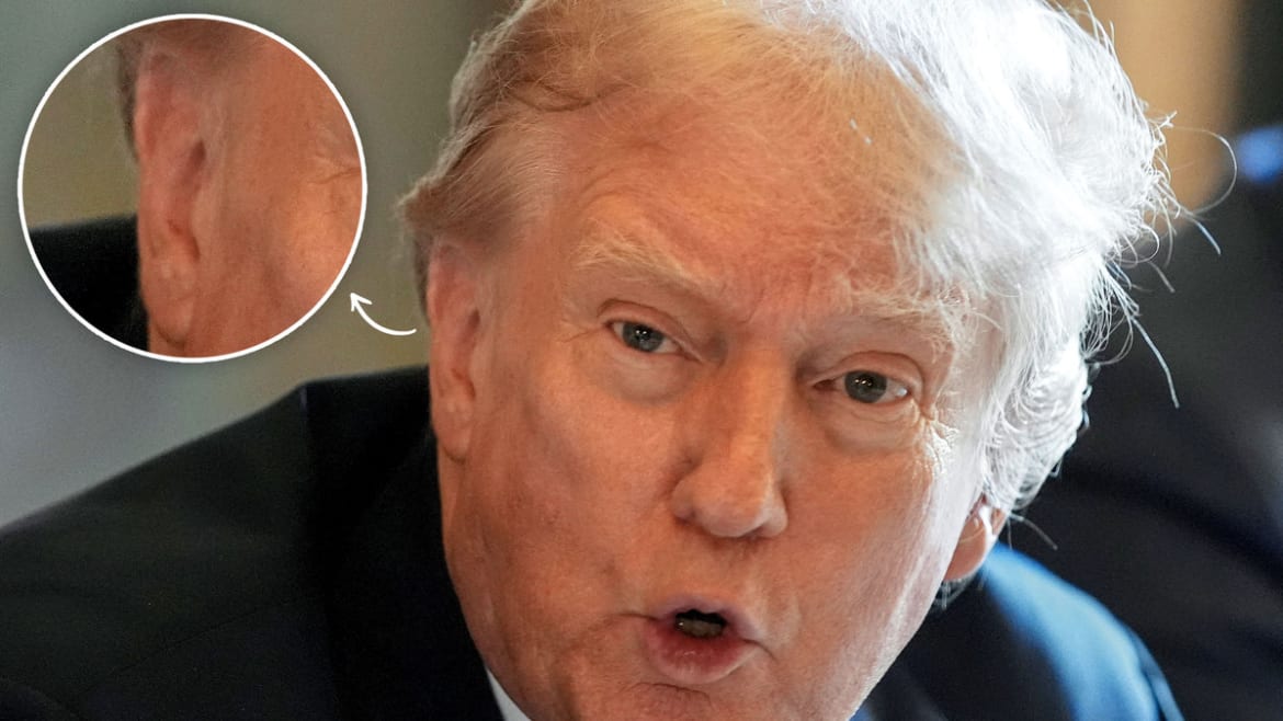Donald Trump Ear Bandage Donald Trump Wears Small Band-aid On Ear During Michigan Rally