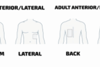 Aed Pad Placement Aed Proper