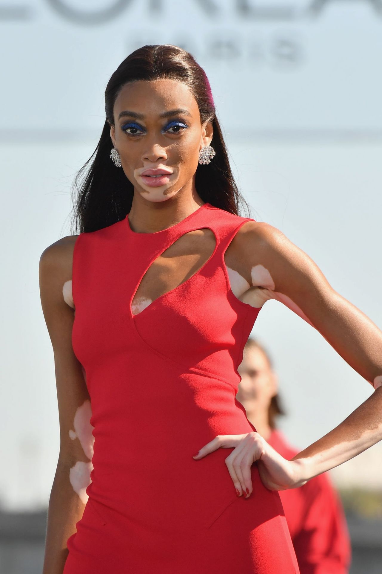Winnie Harlow Winnie Harlow's Trailblazing Supermodel Journey