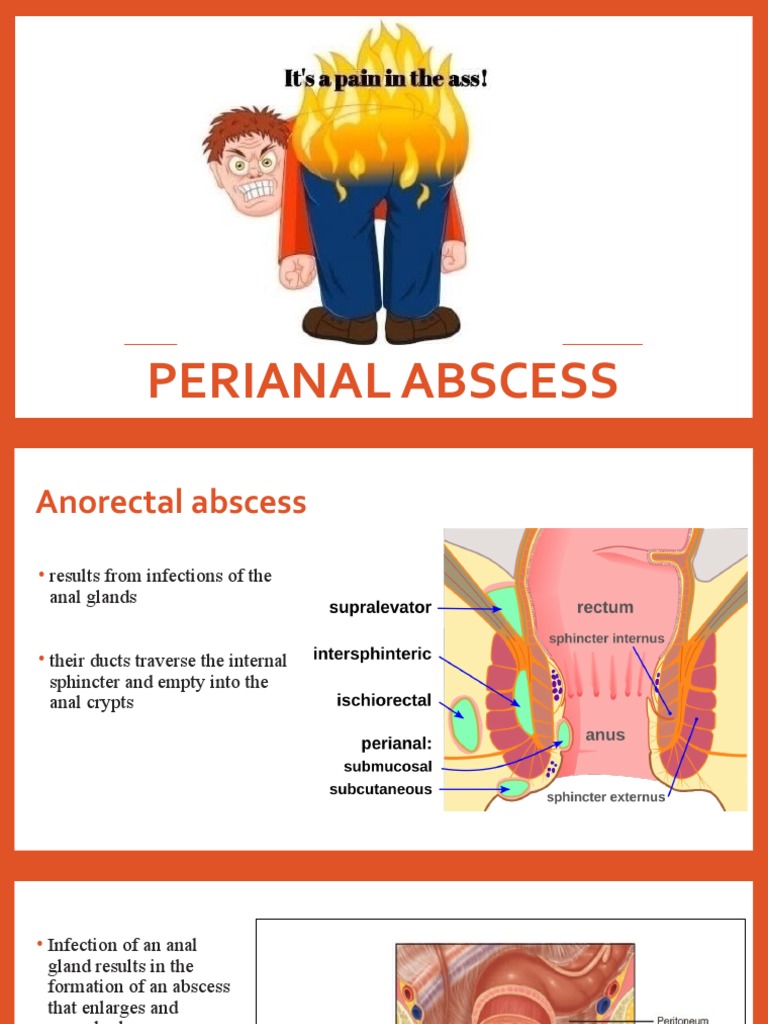 Countries Already In 2025 – Perianal fistula and abscess.pptx