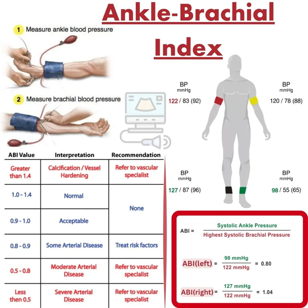  The Ankle-Brachial Index: Test for Peripheral Artery Disease Bildidee 