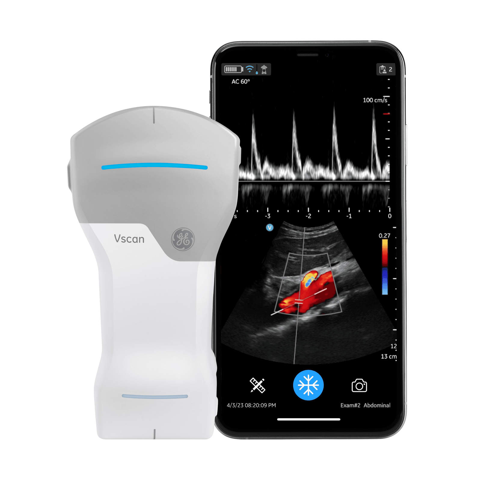 Ultimate Wellness Kitchen Ideas Planner In Canada Ge Vscan Air Cl Handheld Ultrasound System