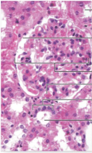 Ultimate Kitchen Luxury Interior Planner In Switzerland Renal Histology Qs (answer W/ Term) Flashcards