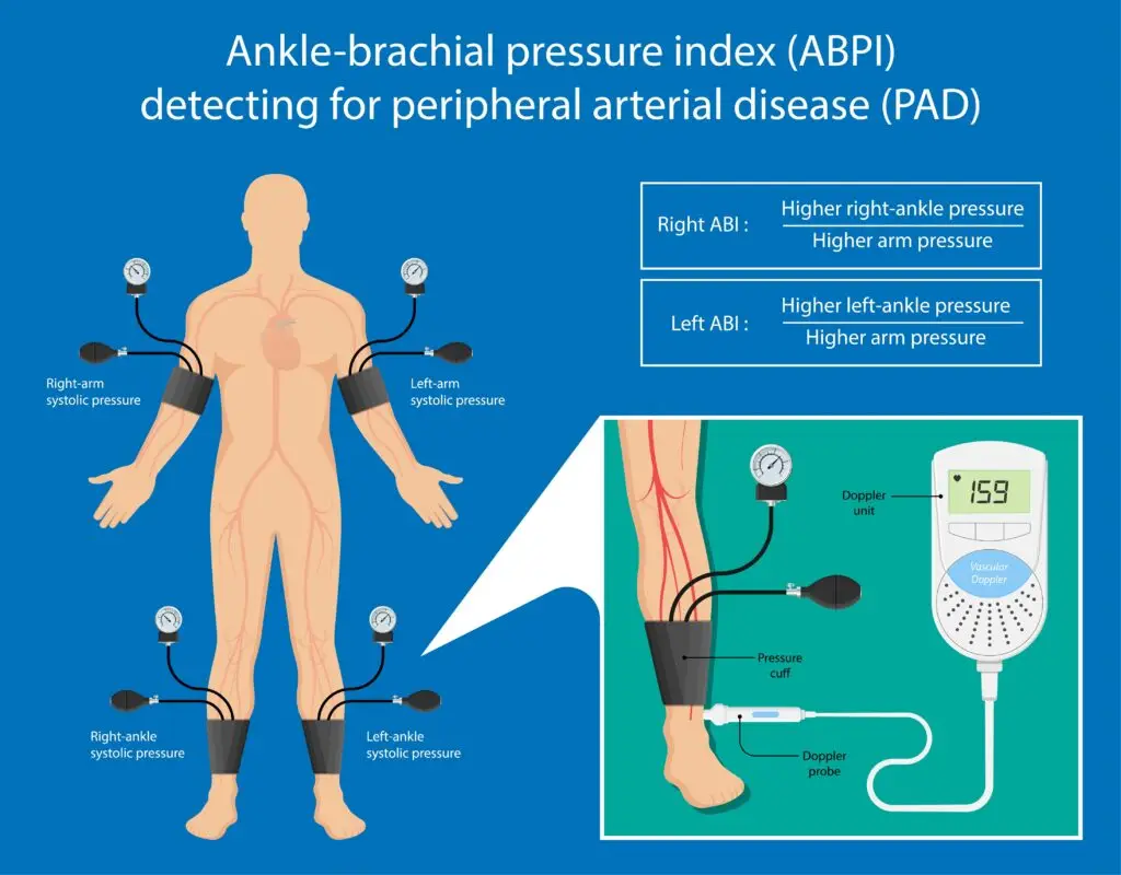  Vascular Testing Mt. Vernon 