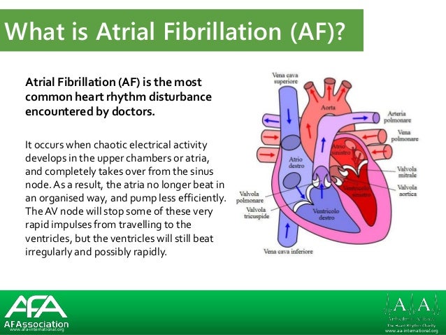  What Is Af , Atrial fibrillation – KXKCUA Illustration 