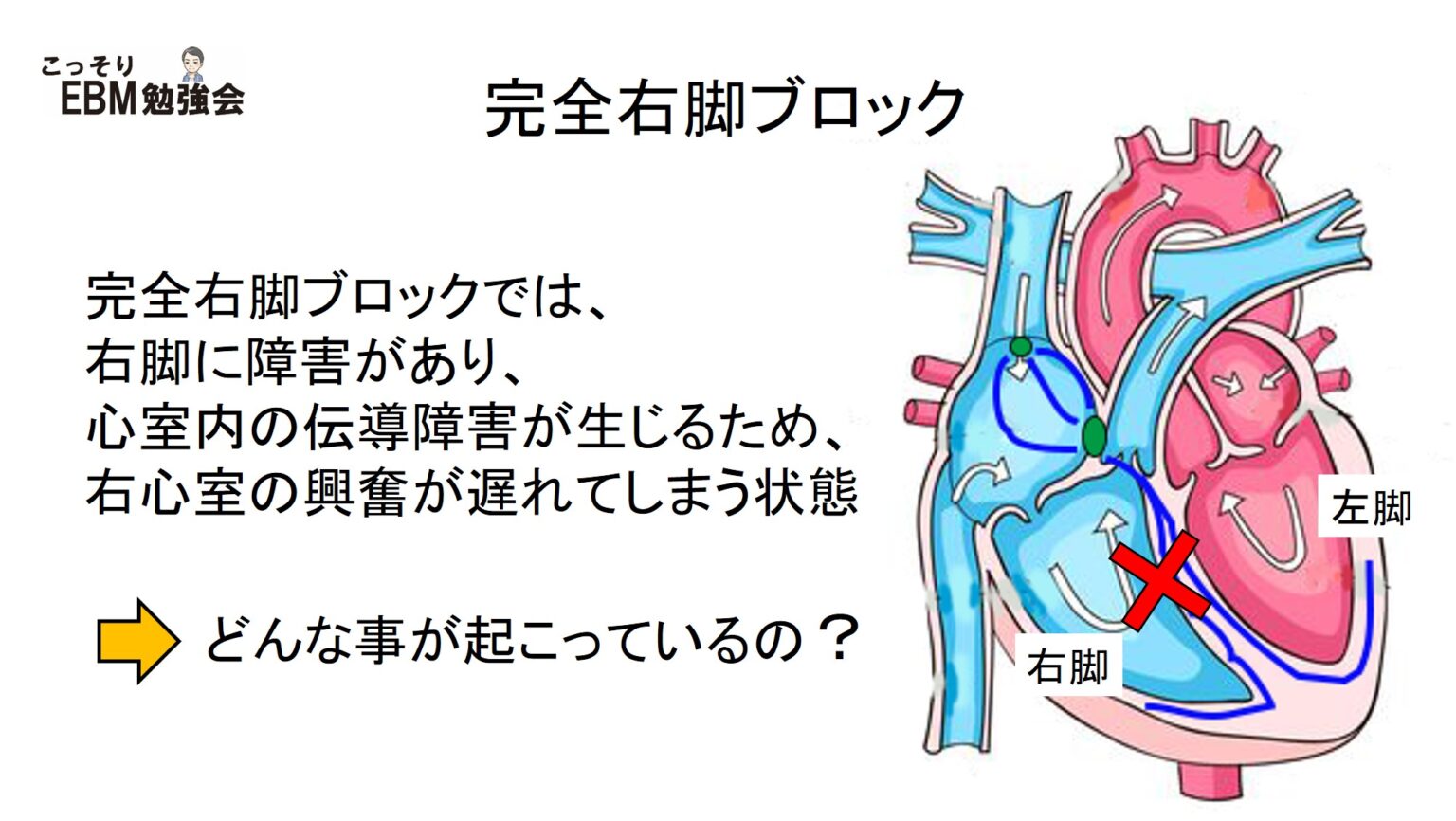  Foto zu Rsrパターンとは – Rsr とは心臓 – 心電図とは /AIC 八重洲クリニック 循環器内科 – WWQL 