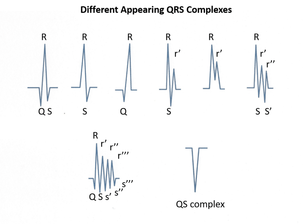  Rsrパターンとは – Rsr とは心臓 – 心電図とは /AIC 八重洲クリニック 循環器内科 – WWQL Bildidee 
